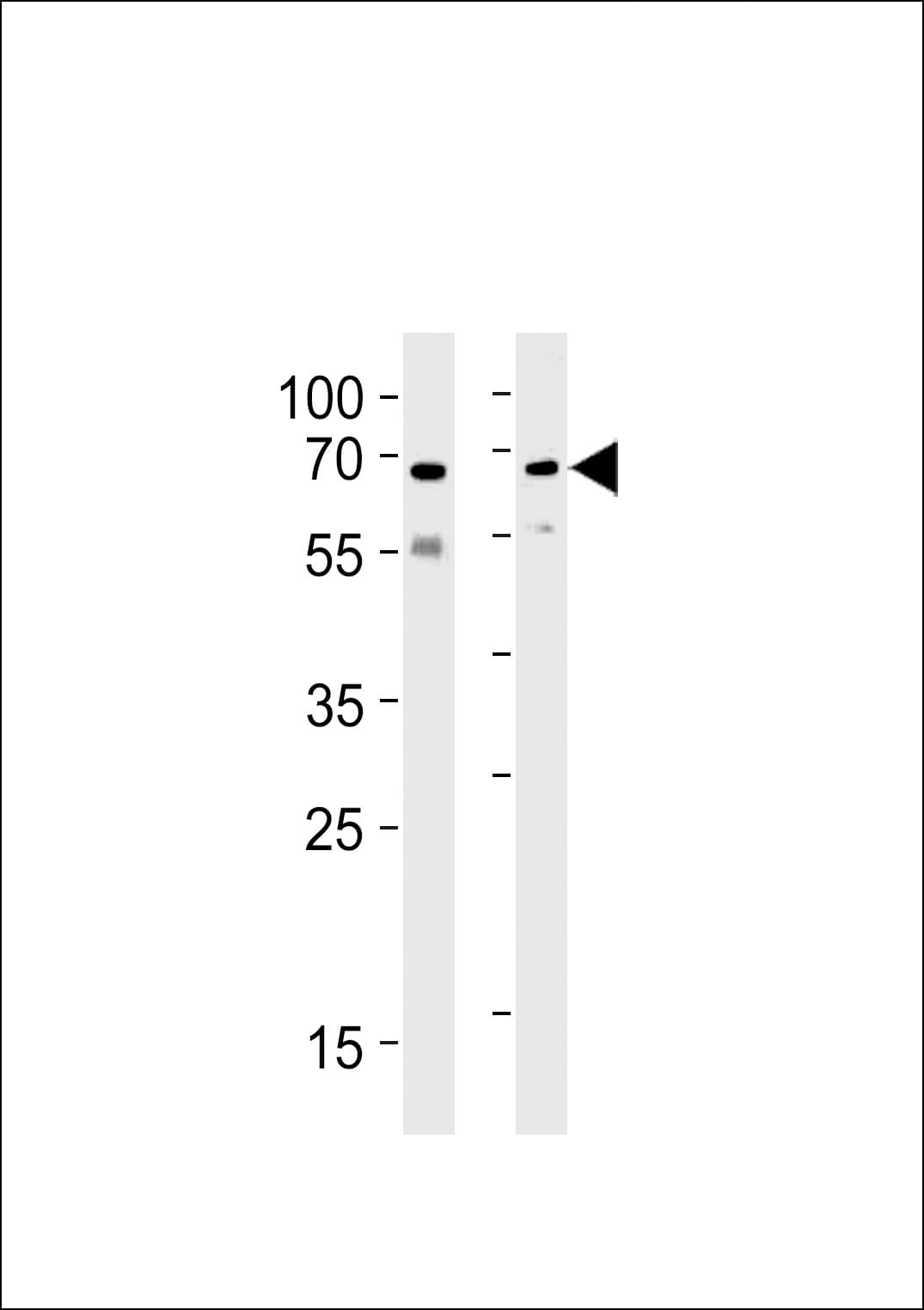 IHC-plus™ UBQLN1 / Ubiquilin Antibody (aa19-49)