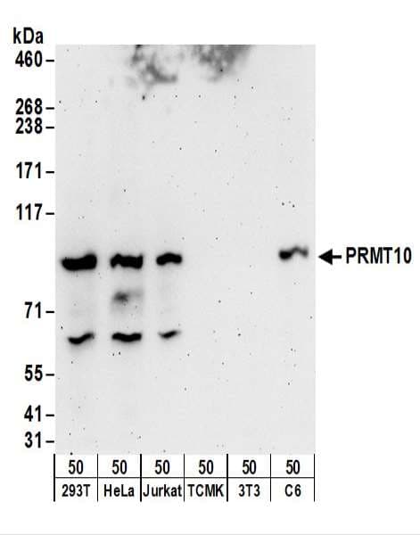PRMT9 / PRMT10 Antibody (aa795-845)