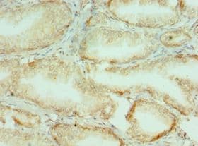 Polyclonal Rabbit anti-Human COL10A1 / Collagen X Antibody (aa521-680, IHC)