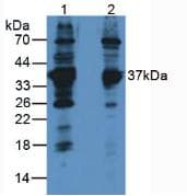 LDHB / Lactate Dehydrogenase B Antibody (aa1-334, PE)