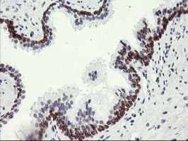 APMAP / C20orf3 Antibody (clone OTI1G8)