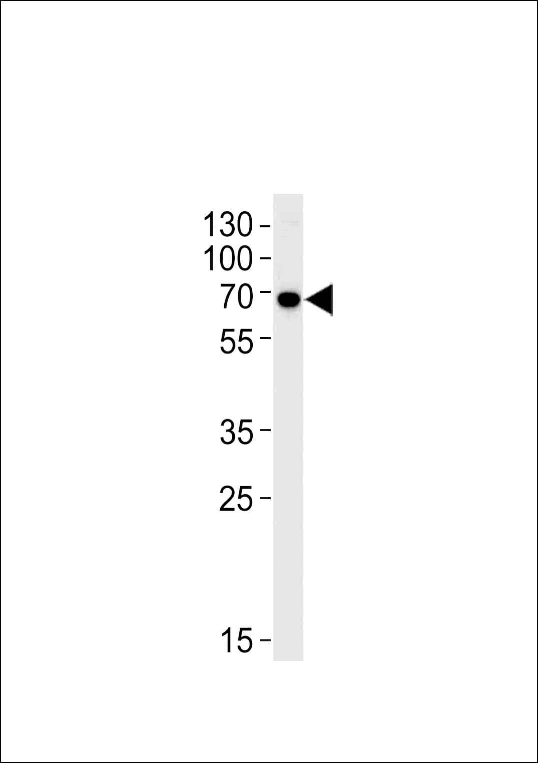 IHC-plus™ Polyclonal Rabbit anti-Human KLC1 / Kinesin Light Chain 1 Antibody (aa389-415, IHC, WB)
