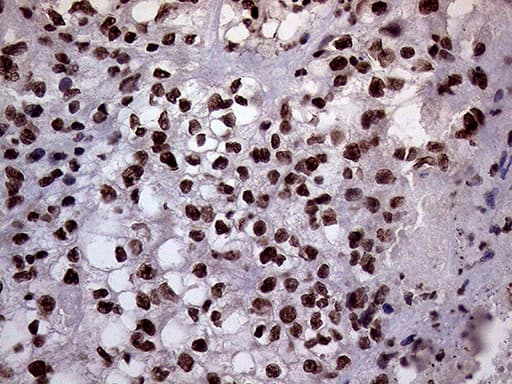 XRN2 Antibody (aa677-779, clone OTI5F4)