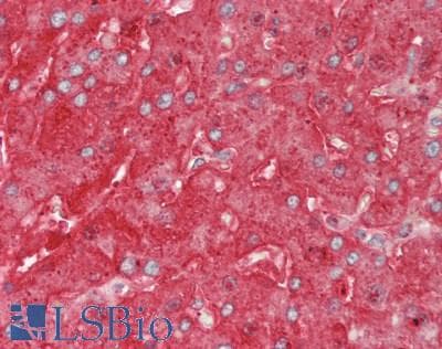 FGG / Fibrinogen Gamma Antibody (aa170-429)