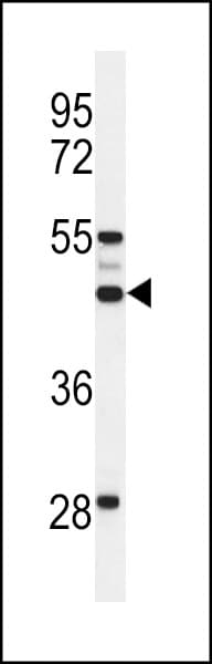 SLC51A / OSTalpha Antibody (aa298-327)