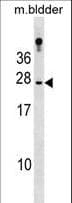 Polyclonal Rabbit anti-Human RBP4 Antibody (aa11-40, WB)