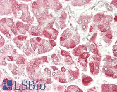 Polyclonal Rabbit anti-Mouse SUV420H1 Antibody (C-Terminus, IHC, WB)