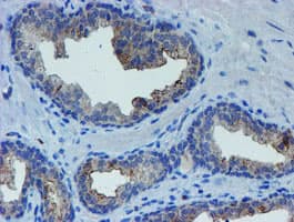 LHX1 Antibody (aa100-362, clone OTI2D5)
