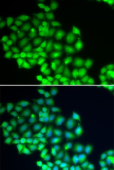 ERCC2 / XPD Antibody