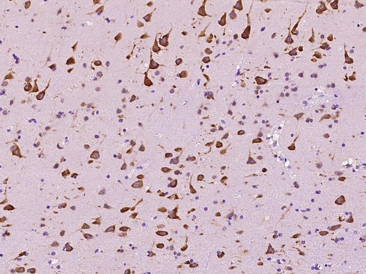 EEF1A2 Antibody