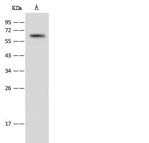 ZAP70 Antibody (Preservative Free)