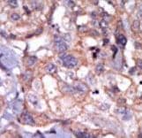 TXK / RLK Antibody (aa22-52)
