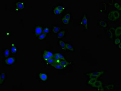 Corneodesmosin / CDSN Antibody