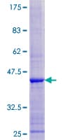 Human ERI3 Protein (Recombinant GST)