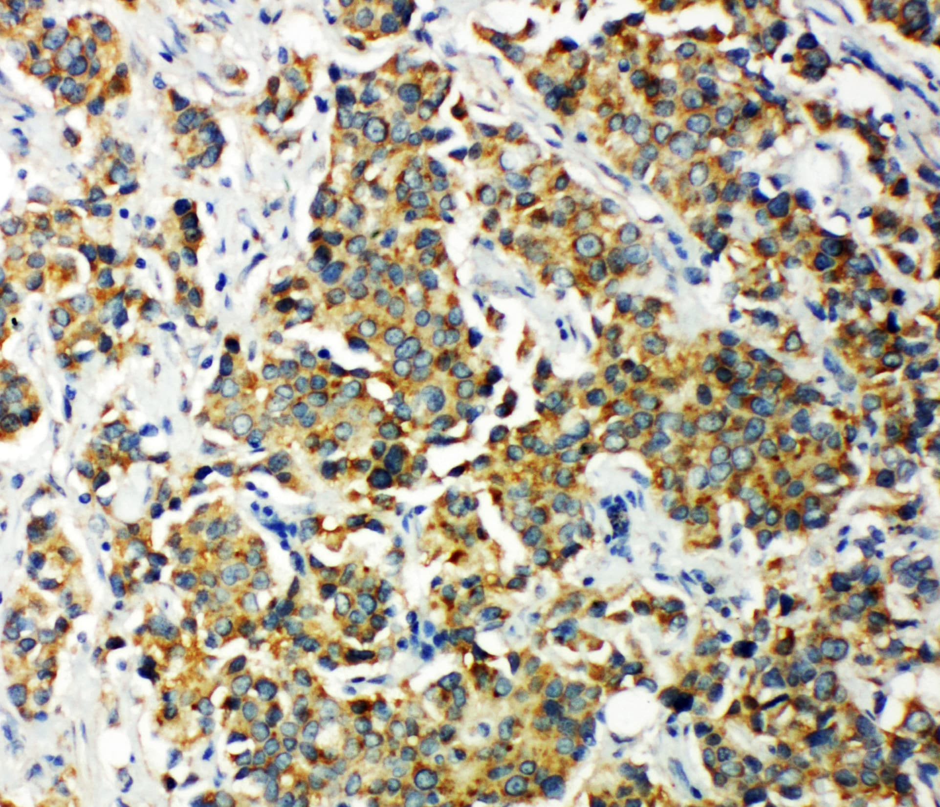 PDK2 Antibody (aa379-392)