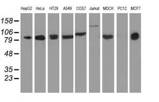 DGKB / DGK Beta Antibody (clone OTI1F9)