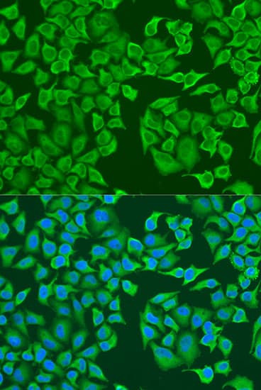 IMP-3 / IGF2BP3 Antibody