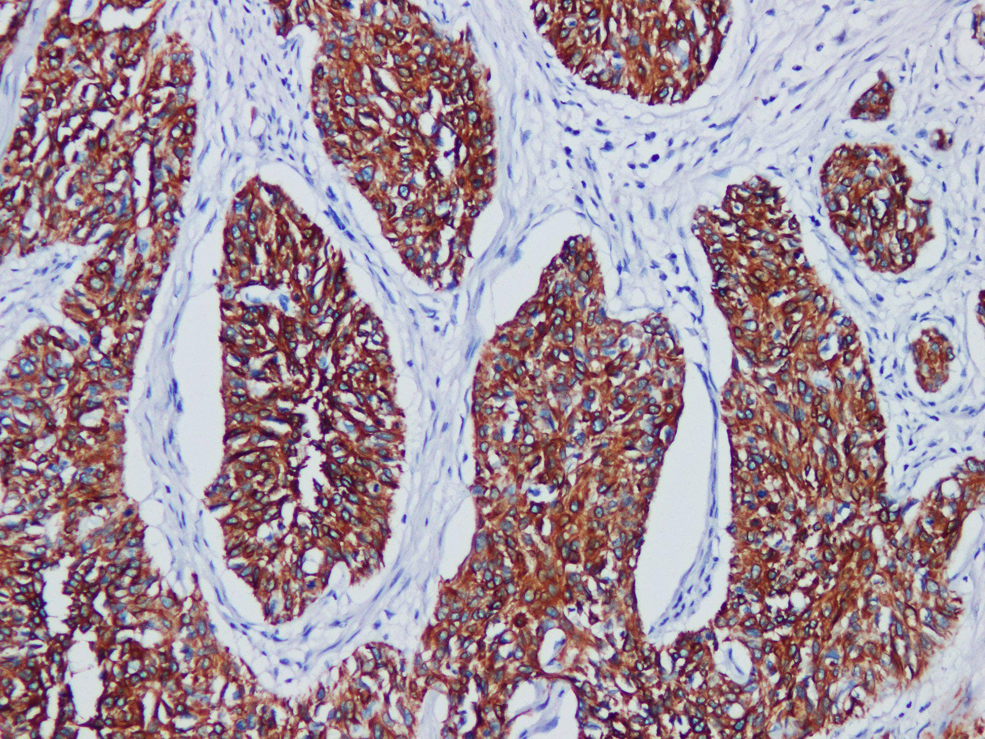 KRT1 / CK1 / Cytokeratin 1 Antibody