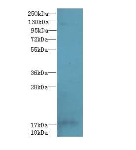 Polyclonal Rabbit anti-Human FAM96A Antibody (WB)