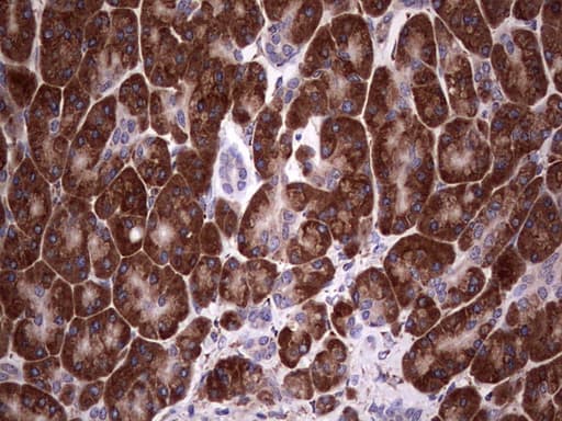 BFSP1 / Filensin Antibody (aa405-665, clone OTI3H6)