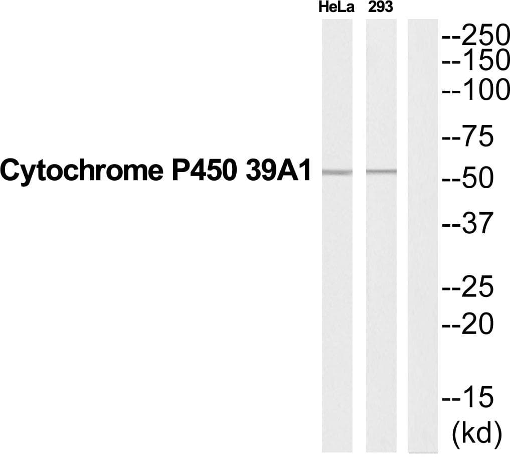 Polyclonal Rabbit anti-Human CYP39A1 Antibody (WB)