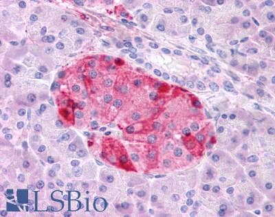 IHC-plus™ GIPR / GIP Receptor Antibody (N-Terminus)