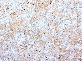 FN1 / Fibronectin Antibody (clone SPM539)