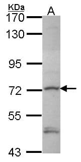 Polyclonal Rabbit anti-Human DTX1 / Deltex Antibody (aa343-617, IHC, WB)