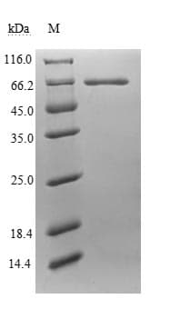 Human Endogenous Retrovirus HERV-K10 putative protease Protein (Recombinant 6His, N-terminus)