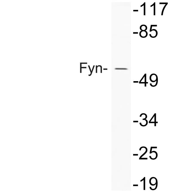 SYN / FYN Antibody (aa158-207)