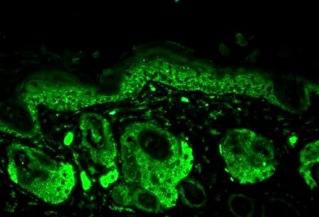 SOD2 / Mn SOD Antibody (APC)