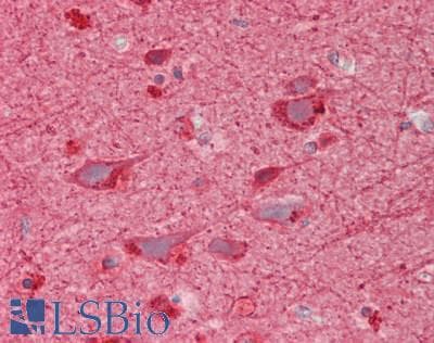 IHC-plus™ DPYSL2 / CRMP2 Antibody (aa475-524)