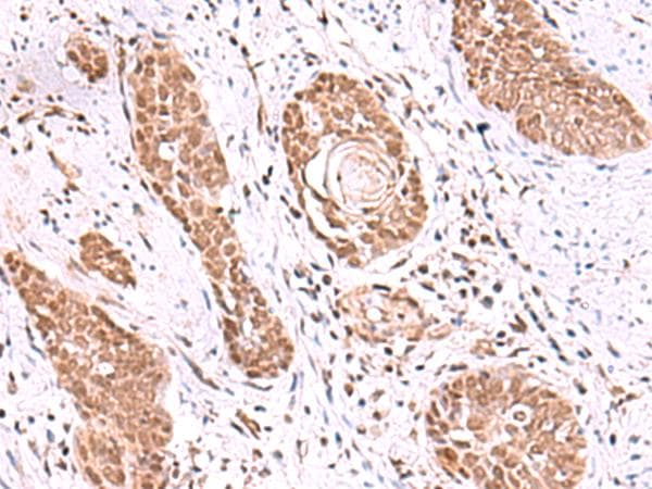 TIP49 / RUVBL1 Antibody