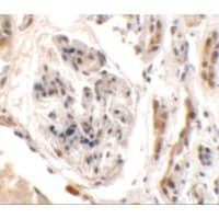 UHRF1BP1L / KIAA0701 Antibody
