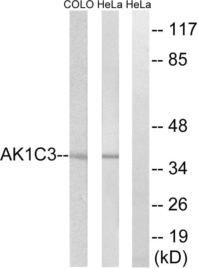 Polyclonal Rabbit anti-Human DDX / AKR1C3 Antibody (WB)