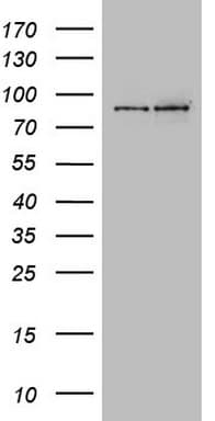 Monoclonal Mouse anti-Human GPR49 / LGR5 Antibody (clone UMAB212, aa22-543, IHC, IF, WB)