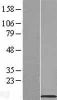 Sarcolipin / SLN Protein (Over-Expression Lysate Myc-DDK (Flag))