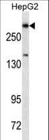 DICER1 / Dicer Antibody (aa879-908)