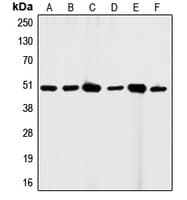 PathPlus™ Polyclonal Rabbit anti-Human CD95 / FAS Antibody (C-Terminus, IHC, WB)