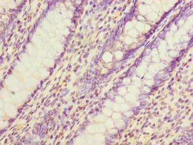 EVA1C Antibody