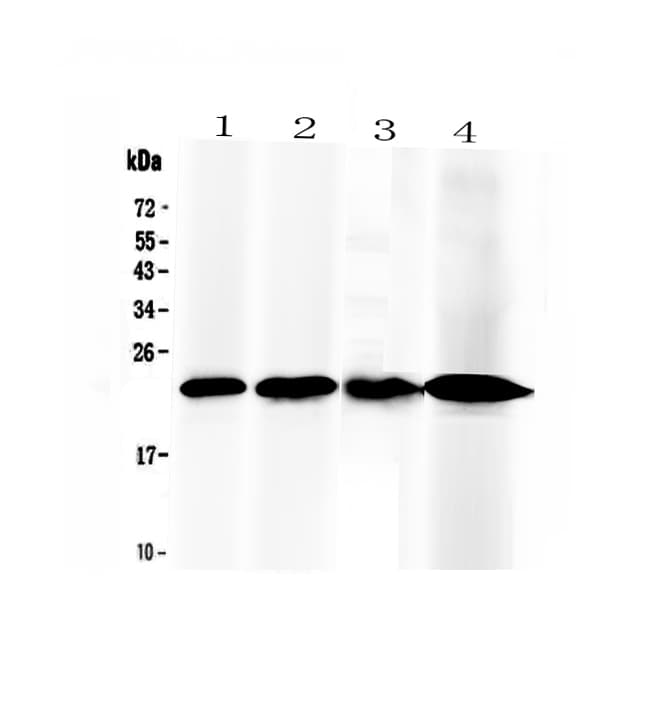 Polyclonal Rabbit anti-Mouse RBP4 Antibody (IHC, WB)