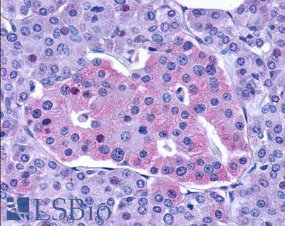 PathPlus™ Polyclonal Rabbit anti-Human GLP1R / GLP-1 Receptor Antibody (N-Terminus, IHC)