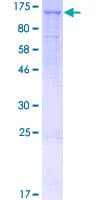 Human NPRB / NPR2 Protein (Recombinant GST)
