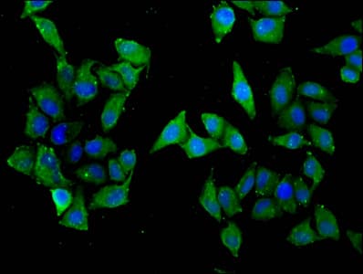 Polyclonal Rabbit anti-Human SLC22A5 / OCTN2 Antibody (IF, WB)