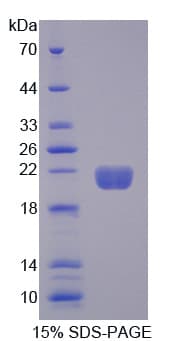 Pig MB / Myoglobin Protein (Recombinant 6His, N-terminus)