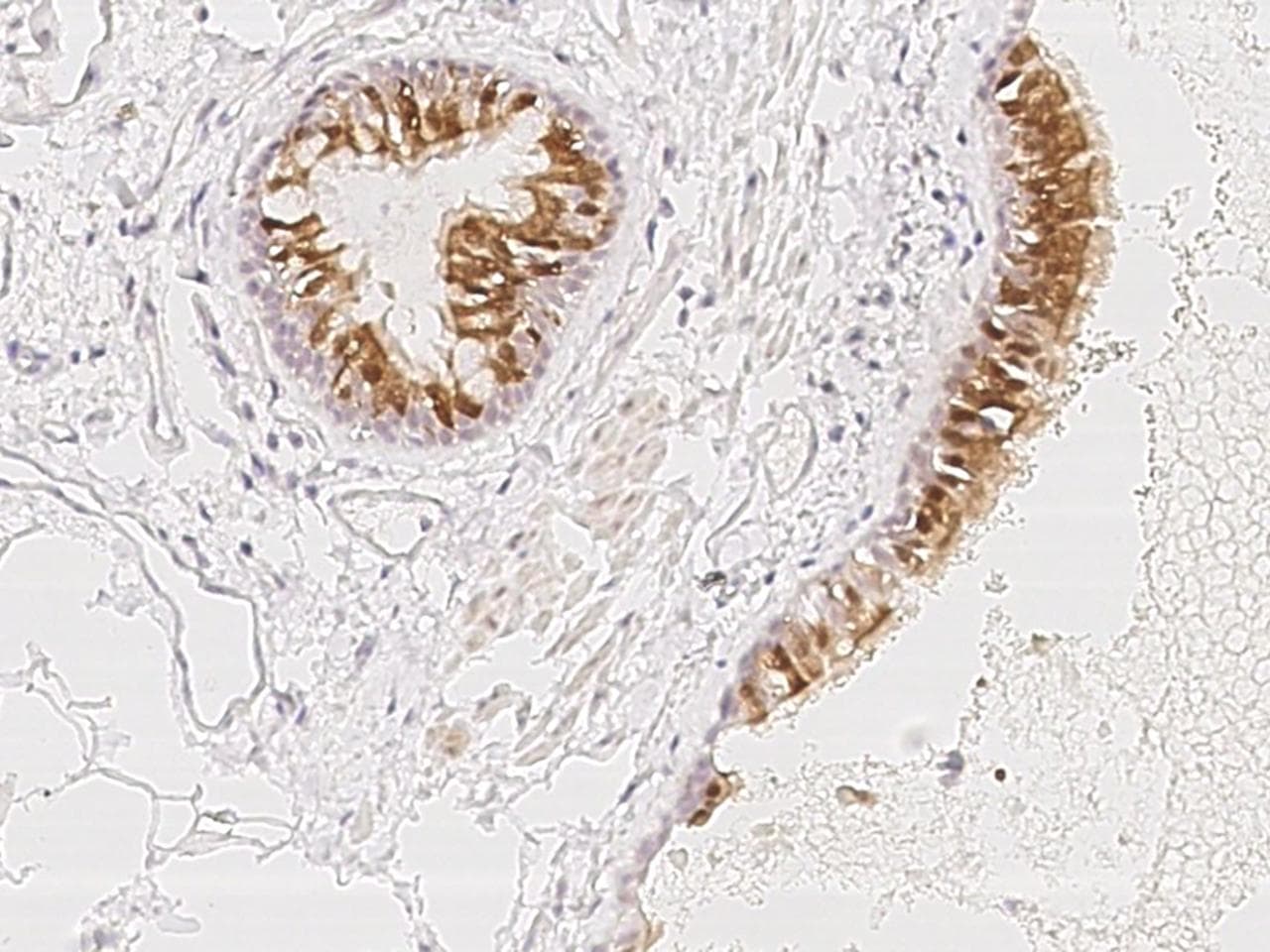 PIH1D3 Antibody