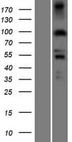 PDXDC1 Protein (Over-Expression Lysate Myc-DDK (Flag))