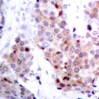 TP53 / p53 Antibody (Internal)