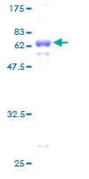 Human CLEC1A / CLEC-1 Protein (Recombinant GST)