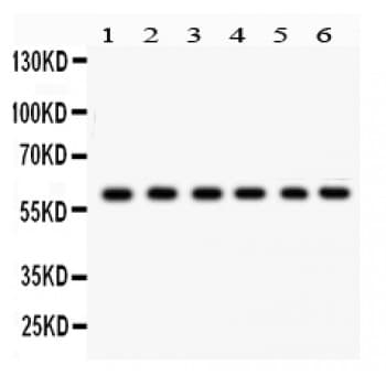 CYP24 / CYP24A1 Antibody (aa153-514)